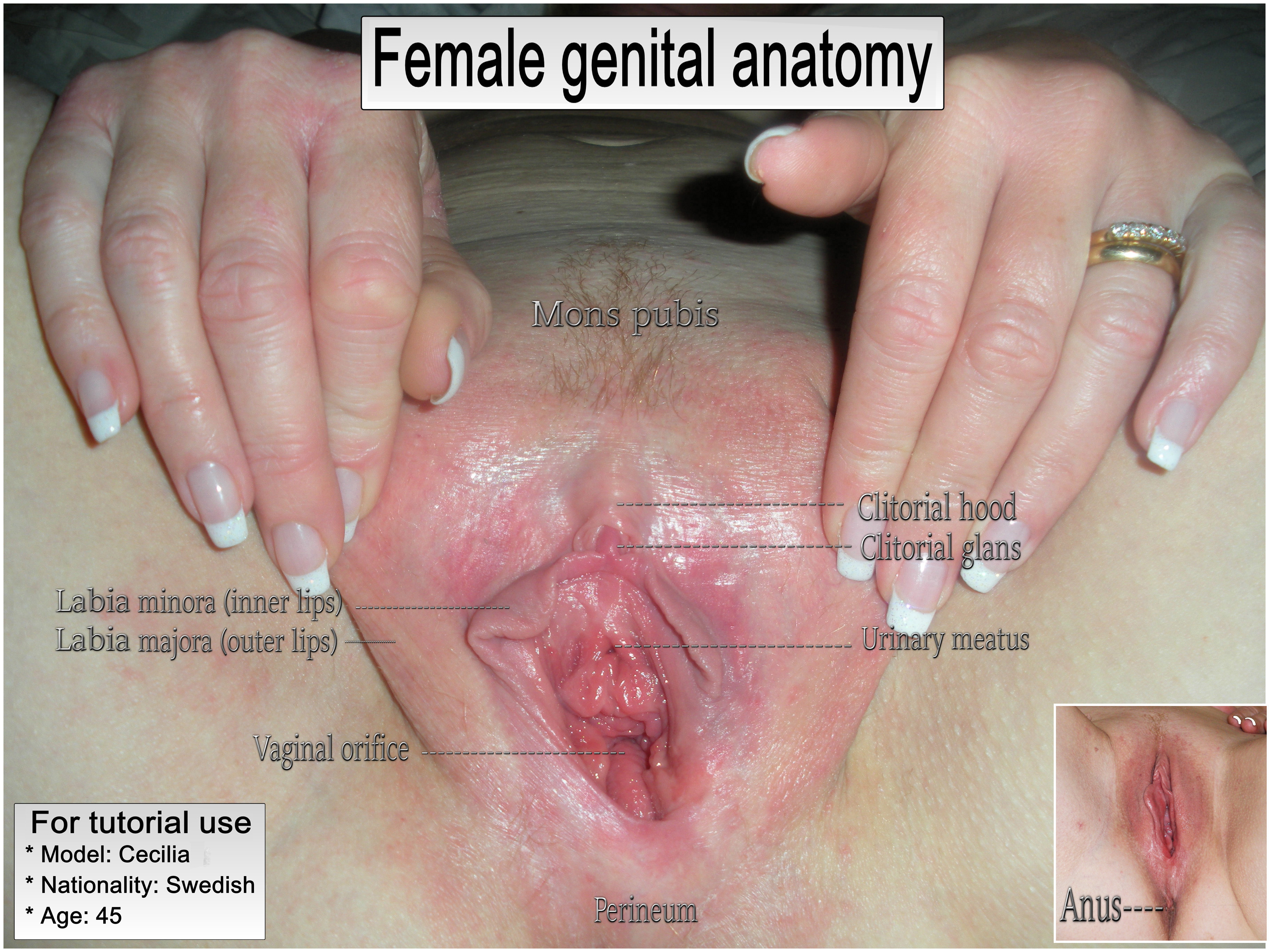 Naked Ladies Vaginas exam porn