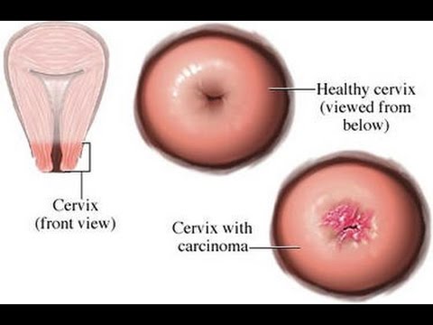 Pound Her Cervix porn deepthroat