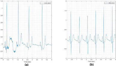 bojan blazevic add photo ecg first anal