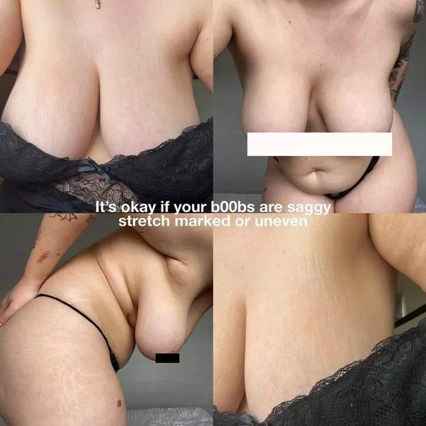 chris pinkalla recommends enormous saggy tits pic