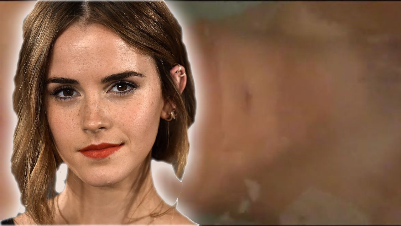 charles scriver add photo emma watson mastubation