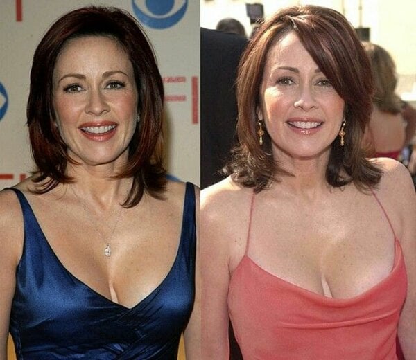 crys fletcher add patricia heaton boobs photo