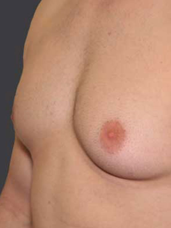 Best of Puffy women nipple