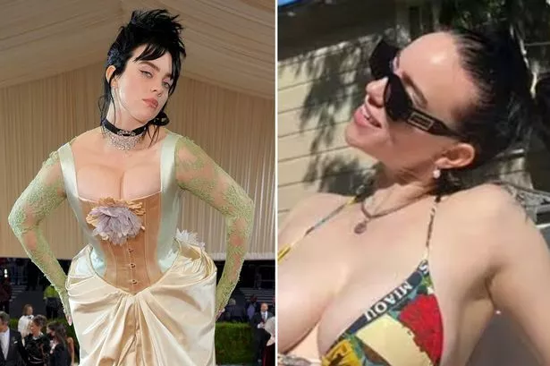 awhina macdonald share billie eilish boob job photos