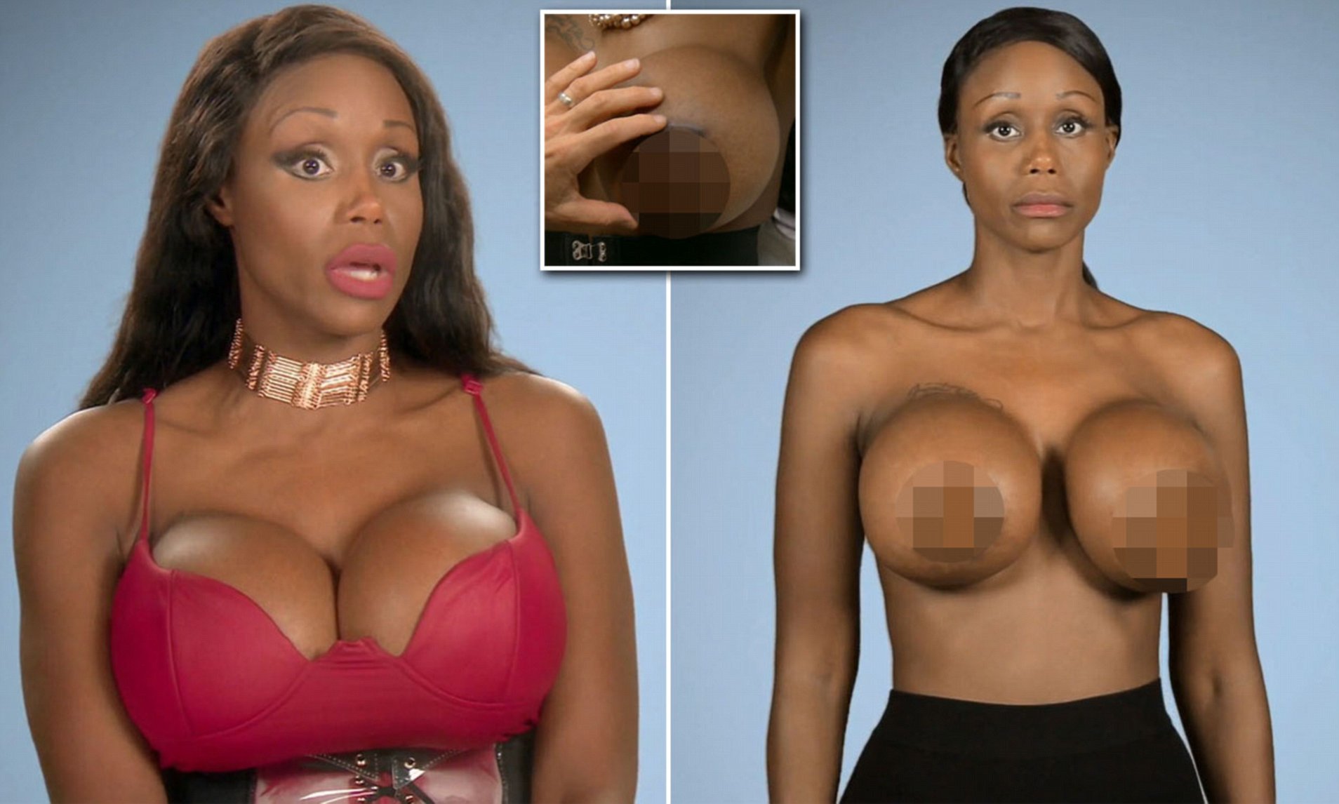 diana finnigan recommends Ebony Puffy Nipple