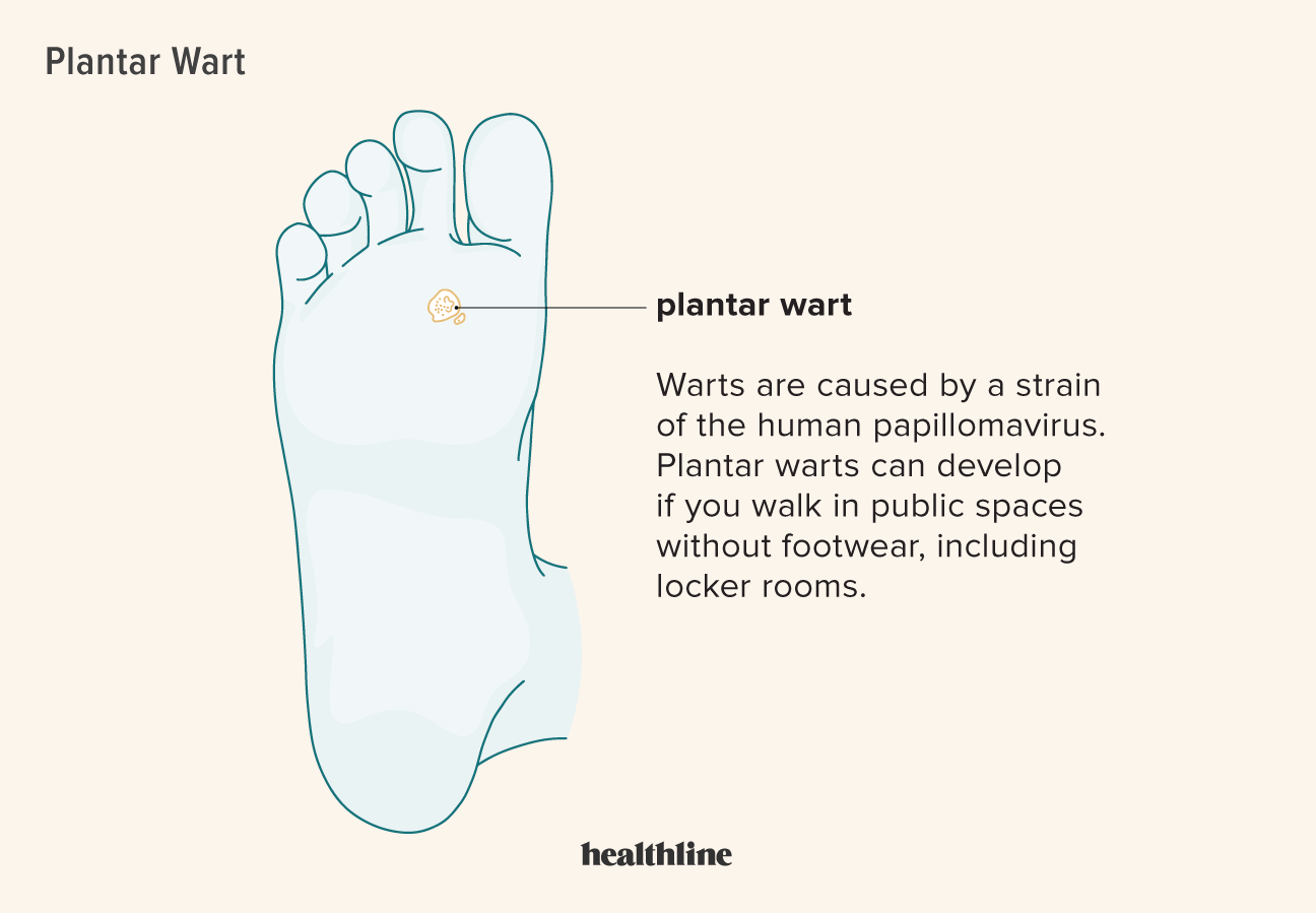 Best of Tiny feet treat