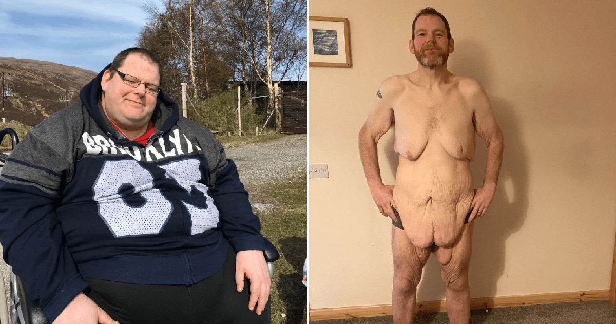 crystal mathewson recommends Obese Men Nude