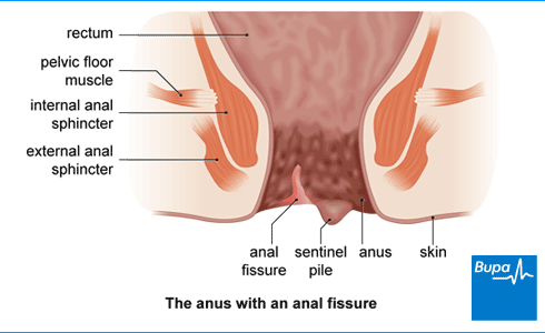 arlinda sadiku recommends Anal In Dubai