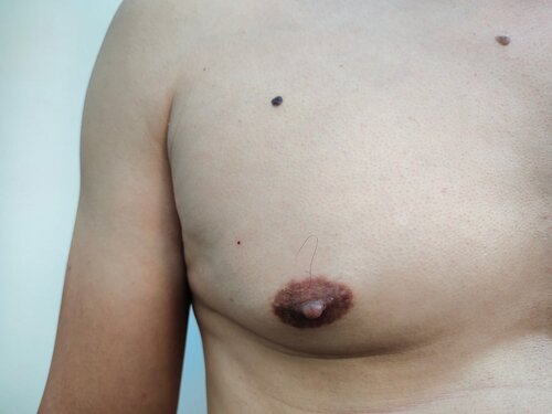 Small Puffy Nipple gira sexual