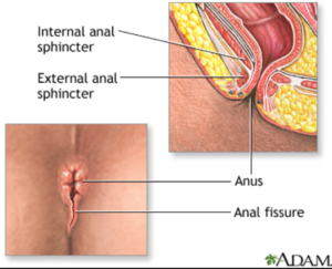 a st john recommends bleeding ass porn pic