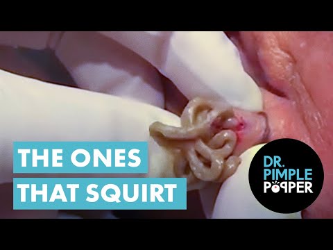 daniel yutuc recommends dr squirt pic