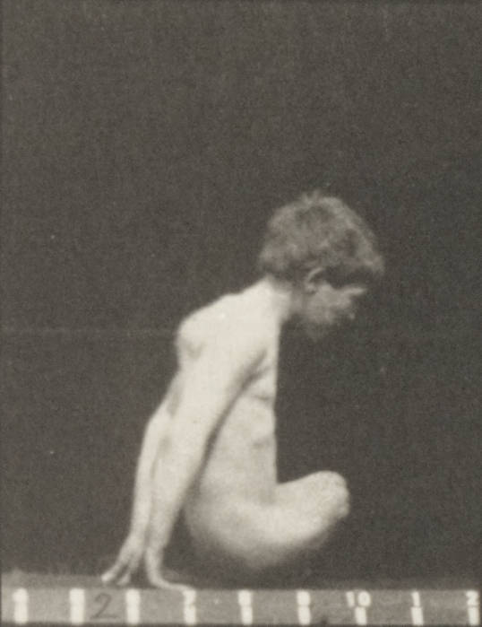 david helgerson add amputee nude photo