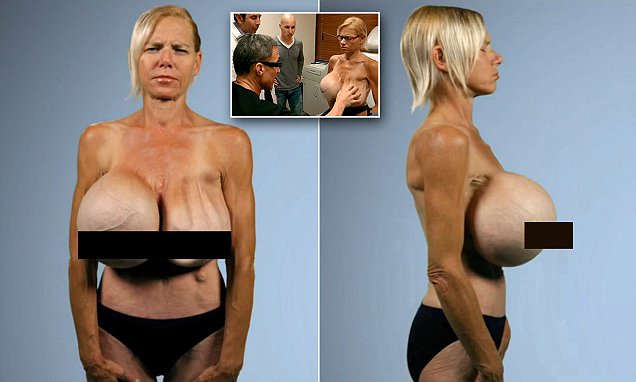 benito amilcare andrea mussoiini recommends Enormous Old Tits