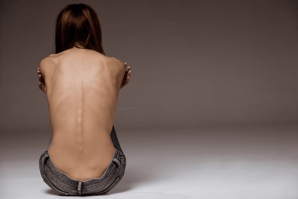 christina rosati recommends Nude Anorexic Women