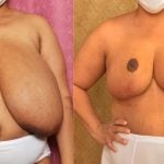 carolyne morris recommends Huge Saggy Titts