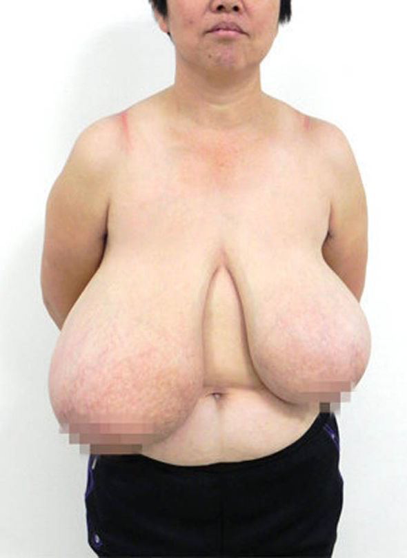 audra baxter recommends huge saggy titts pic