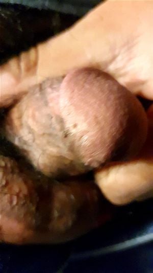 antony richmond add photo micropenis masturbate