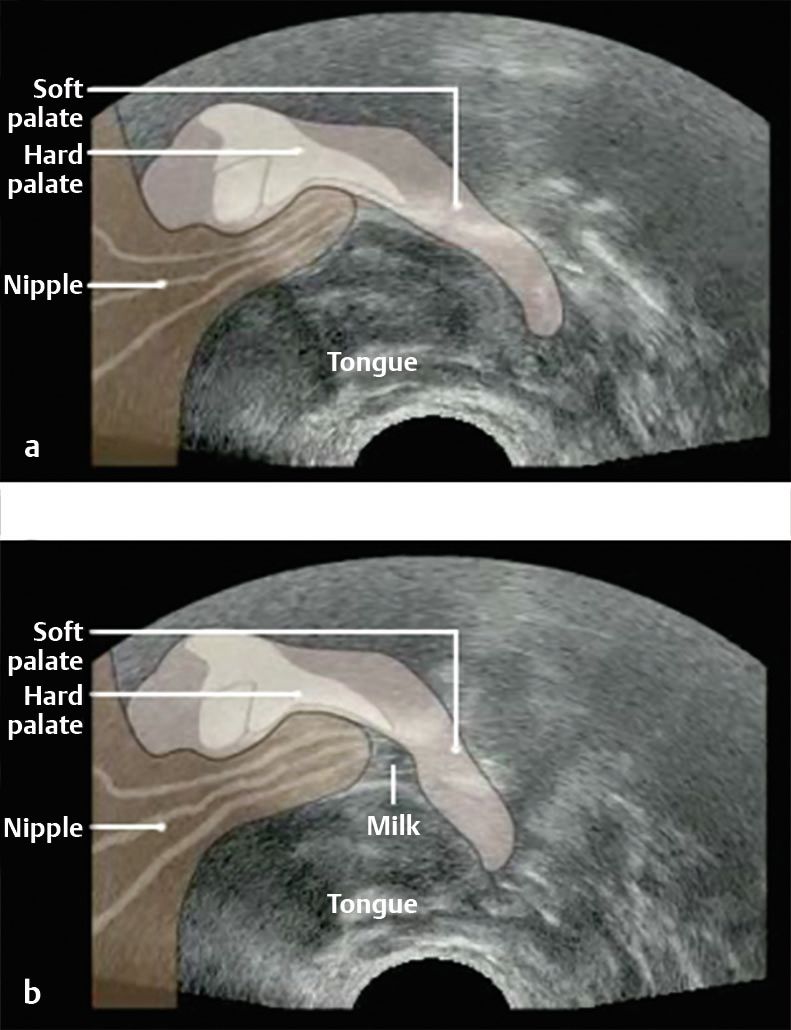 sucking lactating breasts